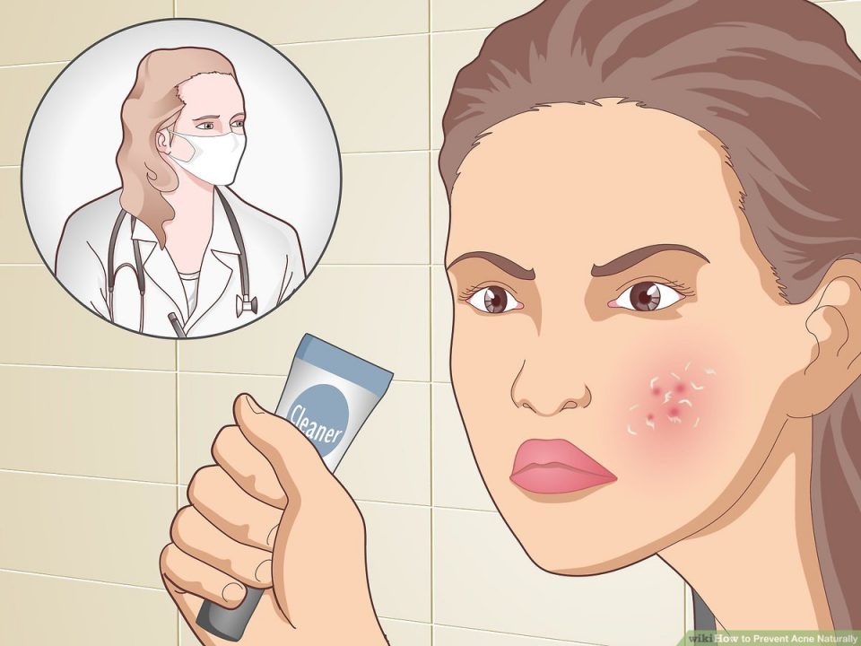 Natural Ways to Prevent Acne