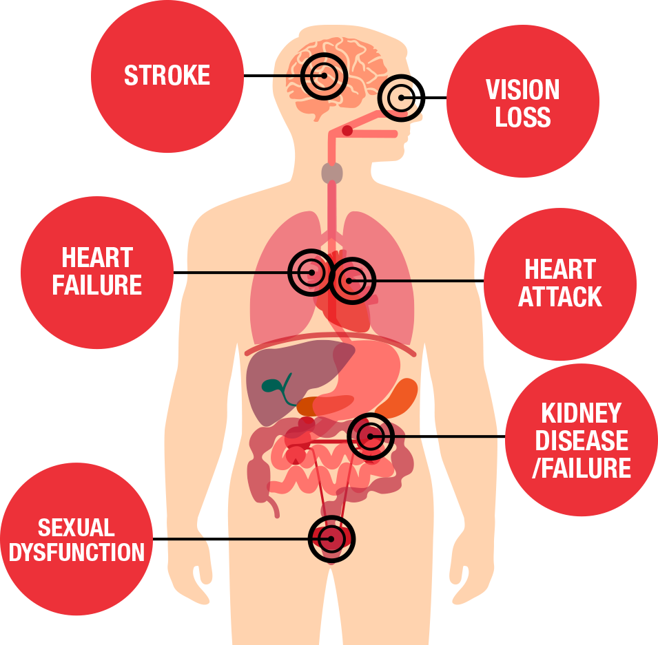 Causes of High Blood Pressure and How to Combat It